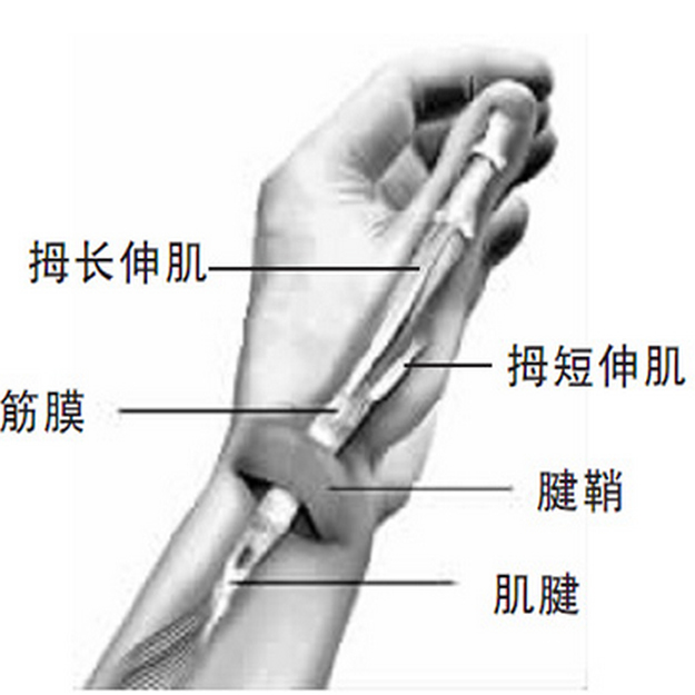 石家庄腱鞘炎医院